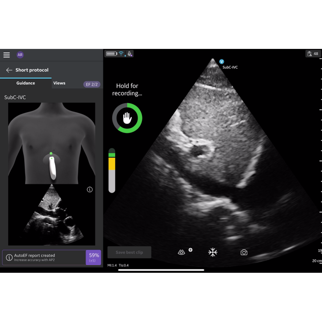 Vscan Air SL Caption AI (Stand-alone) FlexiPackage EUR